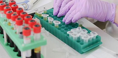 Prywatne pakiety medyczne zyskują popularność – mieszkańcy Brzegu stawiają na