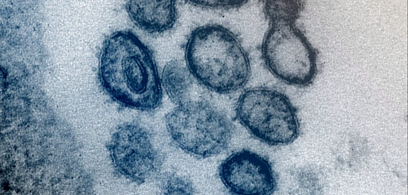 Naukowcy opracowali test krwi przewidujący ciężki przebieg COVID-19