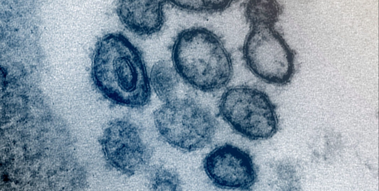 Naukowcy opracowali test krwi przewidujący ciężki przebieg COVID-19