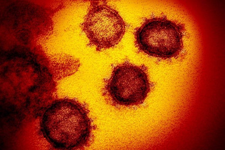 1584 nowe przypadki koronawirusa, to 3 mniej niż piątkowy rekord; zmarły 32 osoby – najwięcej od początku pandemii – raport MZ 26-09