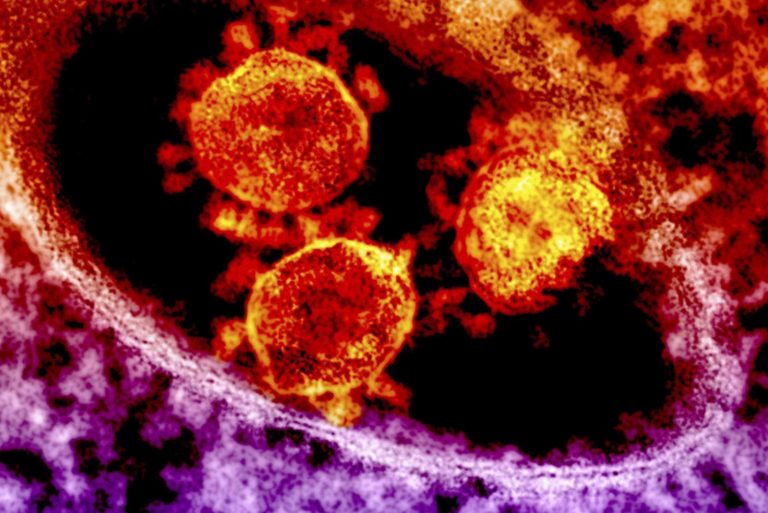 Tak źle jeszcze nie było. 27 143 nowe zakażenia koronawirusem – najwięcej od początku epidemii; zmarło 367 osób – raport MZ 05-11